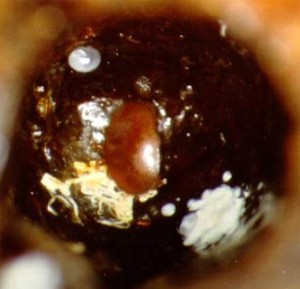 Mite feces