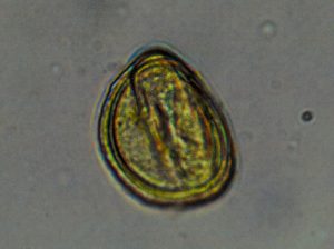 Here is a pollen grain from the honey. Although I have no idea if the pollen and the purple honey are related, I was curious about what I might find.