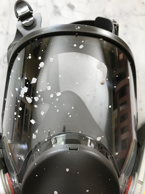 This photo shows how a face mask saved Bill from the splatter of burning-hot liquid from an oxalic acid vaporizer.